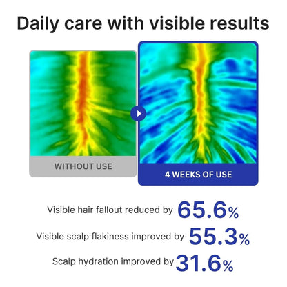 Scalp Strengthening Roll-On Serum – Deoxyribose, Rosemary, EGF & Caffeine for Fuller-Looking Hair